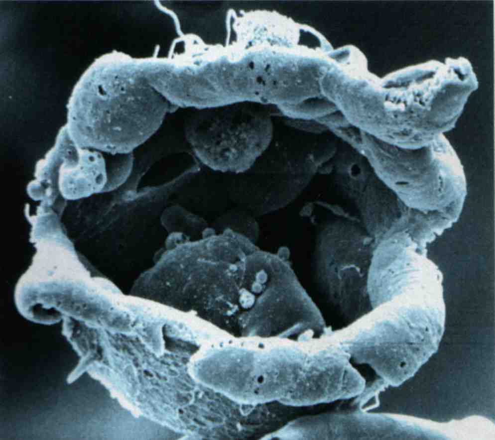 Un blastocyste: un embryon humain de 6 jours